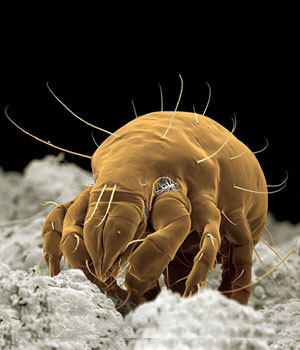 The Most Common Allergenic Dustmite - Electron Scan Image of Dermatophagoides pteronyssinus